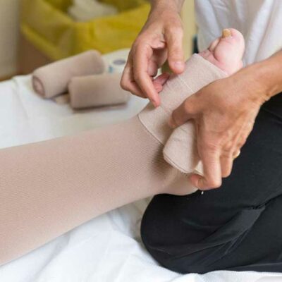 Swollen Legs – Causes and Remedies