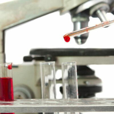 WBC count – Understanding the blood count