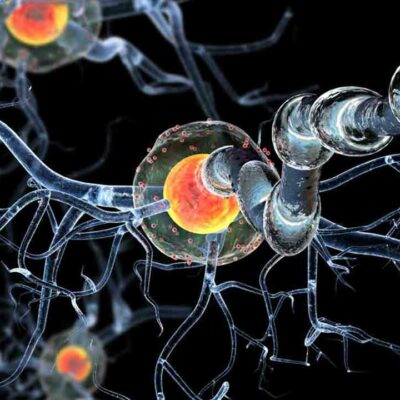 A Few Things to Know about Huntington’s Disease