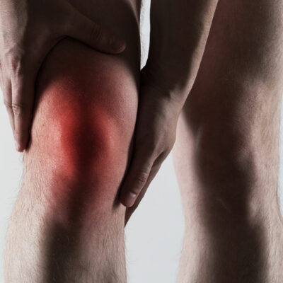 Gout – causes, symptoms, and treatment