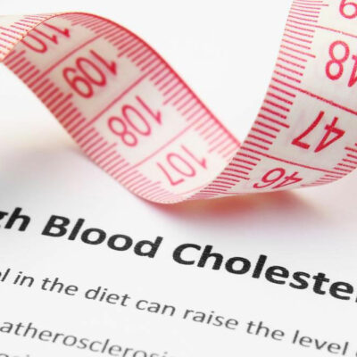 High Cholesterol – Symptoms and Treatment Options